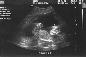 ultrasound sonar from 0 to 20 weeks With Doctor Dr Lebea Medical Practice in Alexandra, Wynberg, Johannesburg, SA